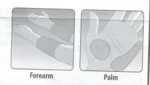 針を刺す場所－掌と腕
